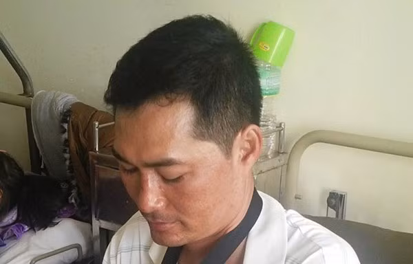 Đuổi cướp, thiếu úy công an bị chém