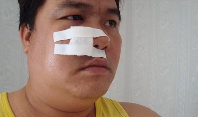 Những lần suýt chết trên phim trường của sao Việt