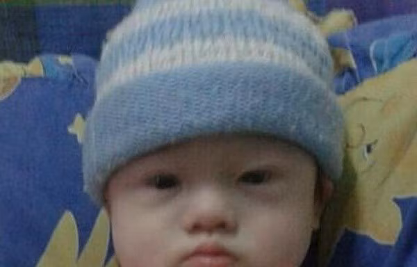Bé Gammy đã bị bỏ lại với người mẹ người Thái Lan sau khi phát hiện bé mắc chứng Down. (Nguồn: dailytelegraph)