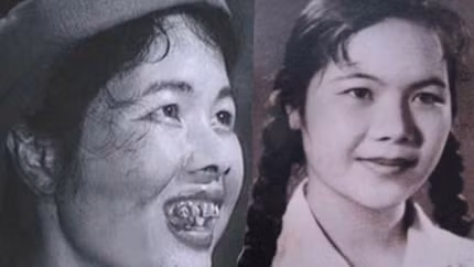 Thị Nở trên phim và ngoài đời thực 