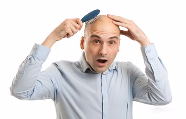 Hói đầu,bạc tóc, nỗi khổ tâm không của riêng ai 