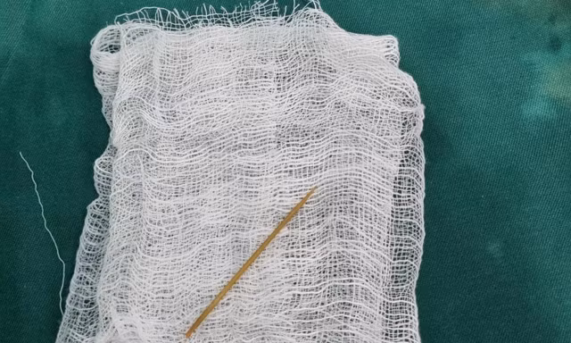 Ngậm tăm dài 5cm nằm xem ti vi rồi ngủ quên, nuốt luôn vào dạ dày