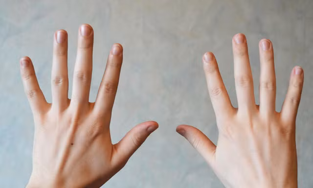 Nhìn móng tay để biết mình có bệnh hay không