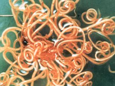 Ăn trứng giun để giảm cân