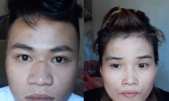 Cướp tiền ở sòng bài rồi dùng dao, súng tấn công làm 5 người bị thương