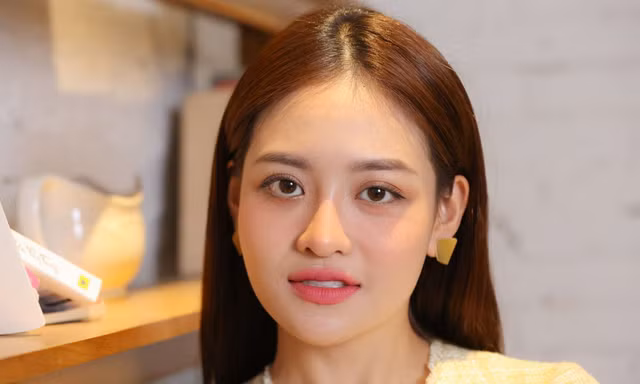 Thùy Anh: ‘Tôi bị miệt thị, họ gọi tôi là quái vật’