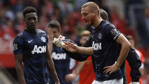 Vidic từng nhiều lần đổ máu vì M.U. 