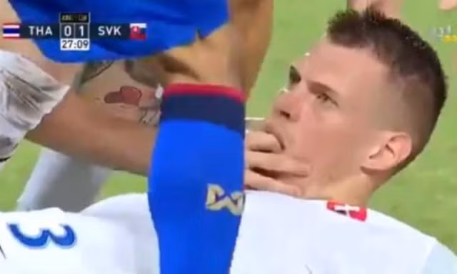 Martin Skrtel chút nữa đã cắn lưỡi trong vô thức.