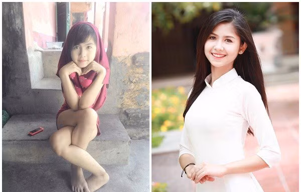 'Hot girl chân khoèo' ngày ấy bây giờ