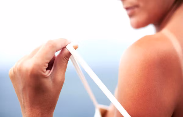 Những mẹo trị da rám nắng siêu tốc mùa hè