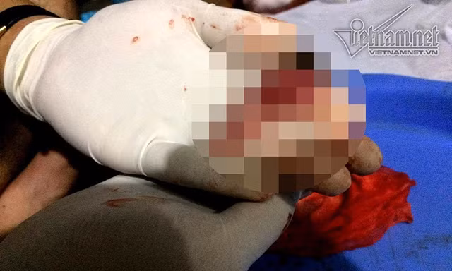 Chàng sinh viên 2 năm đi nhặt 3.000 xác thai nhi