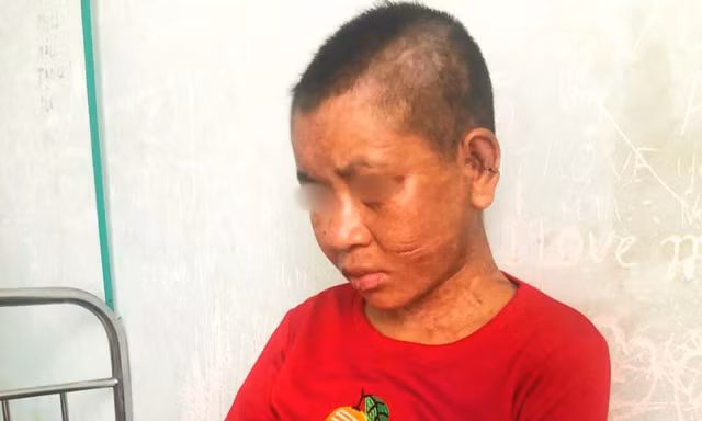 Chị Y Nhiêu vẫn đang tiếp tục điều trị các thương tích