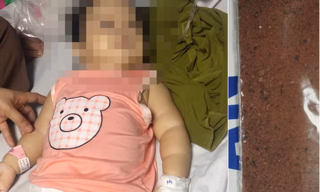 Quảng Bình: Bé gái 11 tháng tuổi ngộ độc chì do 'thuốc cam'