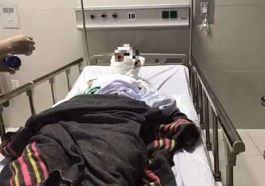 Nạn nhân đang được điều trị tại BV Hữu nghị Việt Nam - Cu Ba - Đồng Hới.