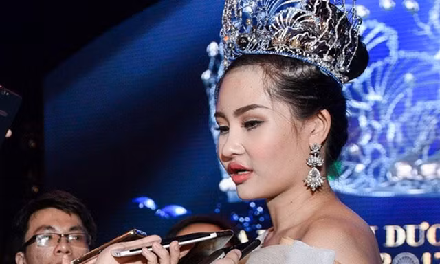 BTC khẳng định Lê Âu Ngân Anh không phẫu thuật thẩm mỹ