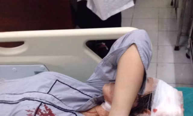 Nữ sinh K.C cấp cứu tại bệnh viện sau khi bị đánh (ảnh mạng xã hội) 