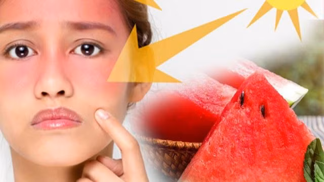 Làm thế nào để bảo vệ làn da xinh trong những ngày nắng nóng cao điểm?