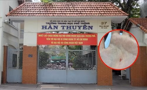 Vụ việc thầy giáo Vật Lý dùng compa đâm chảy máu tay học sinh: Hình thức xử lý ra sao?