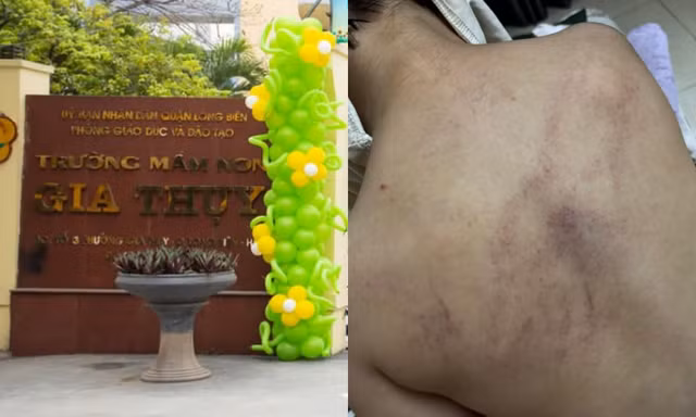 Nghi vấn giáo viên bạo hành trẻ tại trường Mầm non Gia Thụy: Sở GD&ĐT Hà Nội lên tiếng