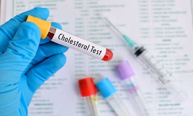 Báo động người Việt Nam thừa Cholesterol