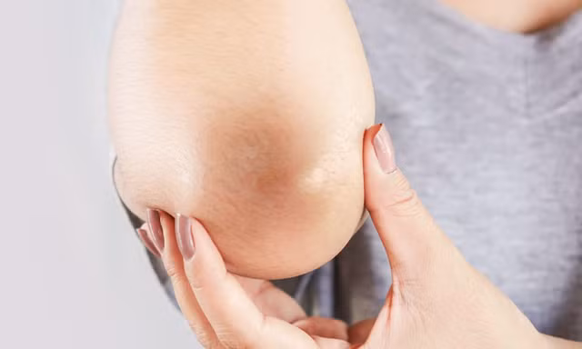 Giúp bạn không cần “cà trắng” những tấm ảnh chụp toàn thân vì đầu gối “đen sì"