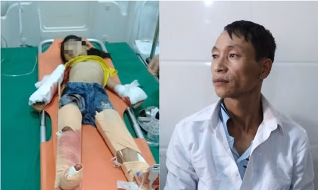 Nỗi đau của người bố có 3 con nhỏ nguy kịch sau vụ nổ kinh hoàng tại gara ô tô ở Nghệ An