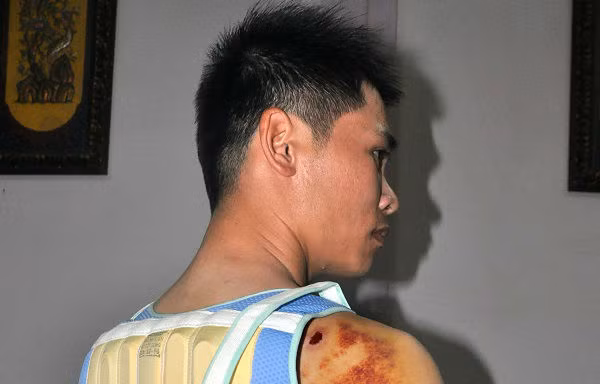 Anh Mậu bị con trai bí thư xã Nhân Cơ đánh