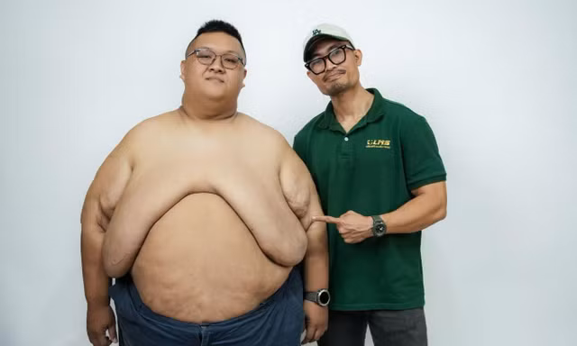 Chàng trai TPHCM bước vào cuộc chiến giảm 150 kg