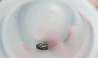 Người phụ nữ bị vật lạ găm vào đầu, nghi đạn lạc