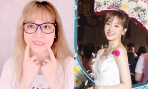 Dấu hiệu cho thấy Hari Won đã vượt qua chứng bệnh liệt cơ mặt