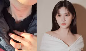 Bạn trai cũ Kim Sae Ron tiết lộ cô thường bị bạo hành, gia đình phớt lờ, độ tin cậy tới đâu?