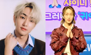 Onew SHINee sụt cân nghiêm trọng, tình trạng sức khỏe khiến fan lo lắng