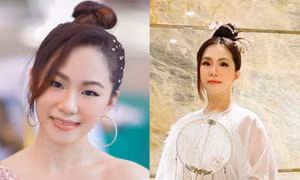 Lương Bích Hữu: Đường tình duyên lận đận, từng bị bỏng nặng đến mức phải tạm dừng ca hát