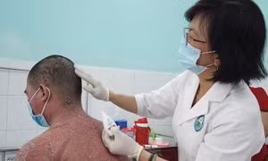 Người đàn ông bị lột da toàn thân vì trị bệnh theo thầy thuốc 'mạng'