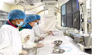 Người đàn ông đột quỵ vì giác hơi