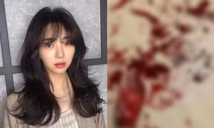 Mina (AOA) đăng ảnh cổ tay đầy máu, khẳng định: “Các người chẳng biết gì về tôi cả”