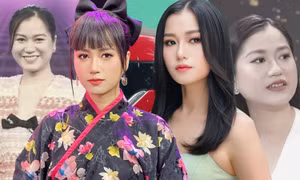 Lâm Vỹ Dạ vướng nghi vấn "đụng dao kéo" chỉ vì nhan sắc ngày càng thăng hạng