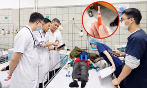 32 học sinh Tiểu học ngộ độc thuốc diệt chuột đang điều trị tại Bệnh viện Bạch Mai