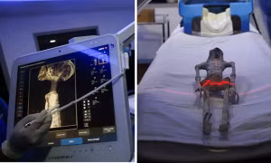 Kiểm tra hóa thạch của “người hành tinh khác” ở Mexico, bác sĩ kết luận thế nào?