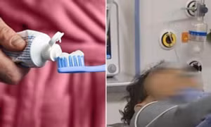 Lý do bạn nên ngủ đủ giấc: Một người nuốt luôn bàn chải vì đánh răng trong khi buồn ngủ