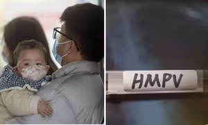 Virus HMPV là gì, tại sao số ca nhiễm tăng mạnh và điều này có đáng lo không?
