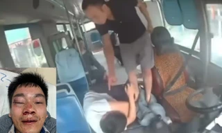 Sau va chạm giao thông, lái xe buýt ở Hà Nội bị đánh nhập viện