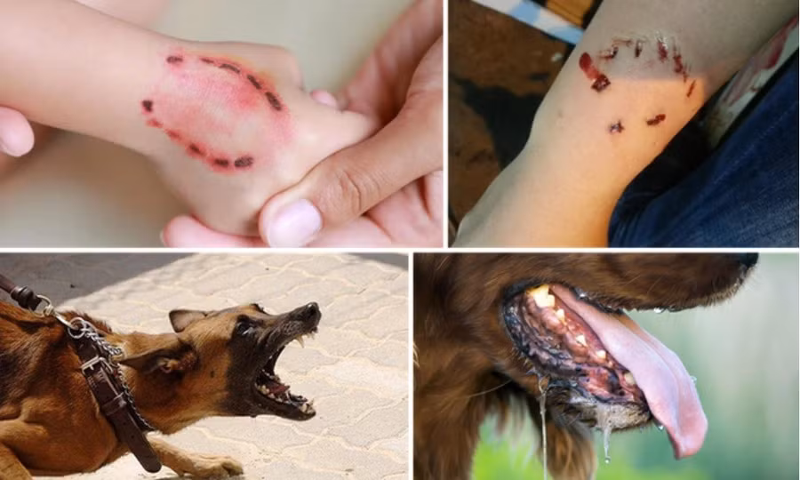3 người bị chó dại cắn tử vong, TPHCM cảnh báo nóng