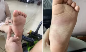 Xác minh thông tin bé trai 3 tuổi nghi bị giáo viên bạo hành ở Hưng Yên