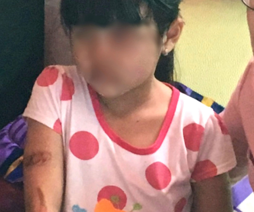 Em N.H.N.T nghi bị cha ruột và mẹ kế bạo hành vẫn chưa thể đến trường.