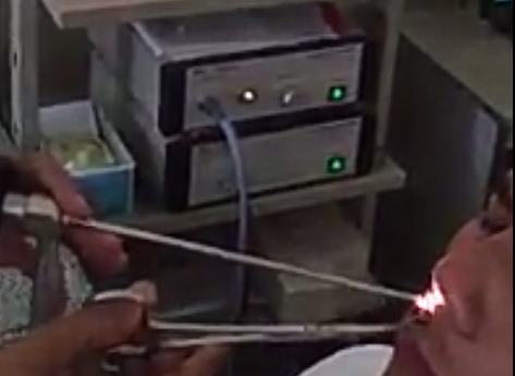 Đỉa sống trong khoang mũi do thói quen tắm rửa, uống nước sông, suối