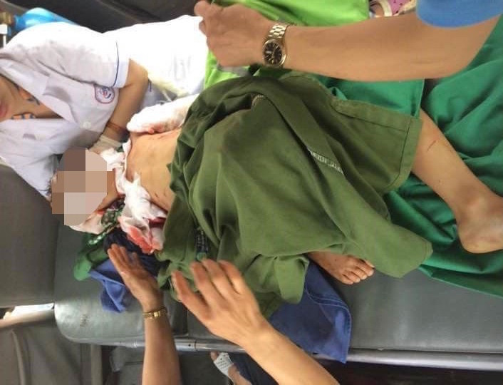 Bé trai 7 tuổi nhập viện trong tình trạng nguy kịch