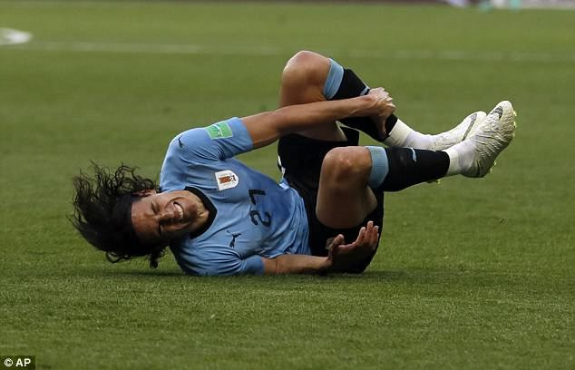 Cavni dính chấn thương trọng trận đấu gặp Bồ Đào Nha