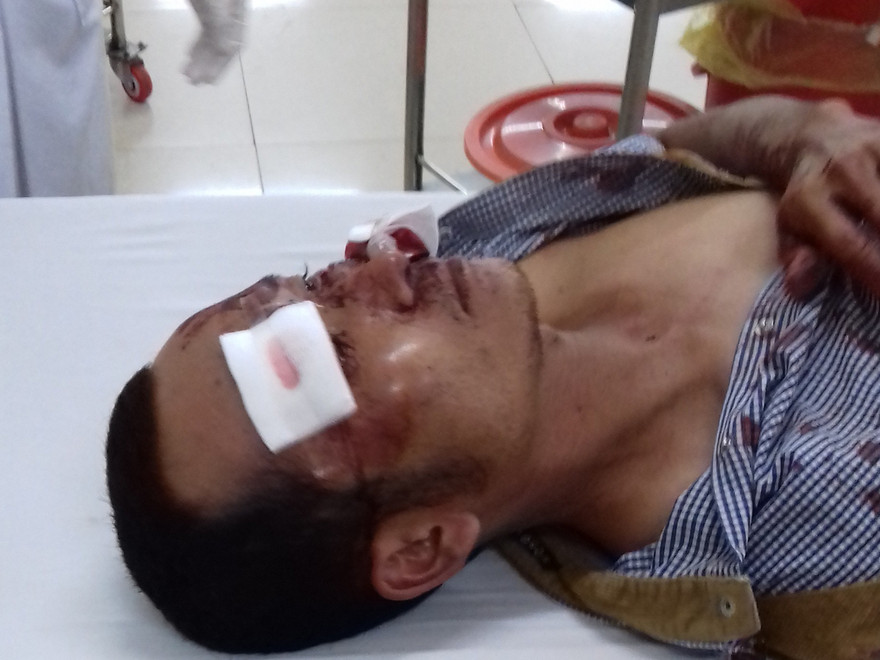 Anh Dũng sau trận đòn "thập tử nhất sinh" từ hàng xóm.