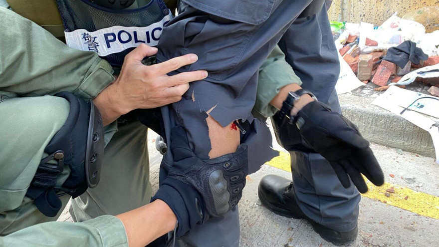 Một cảnh sát Hong Kong bị tên bắn vào chân. Ảnh: AP.